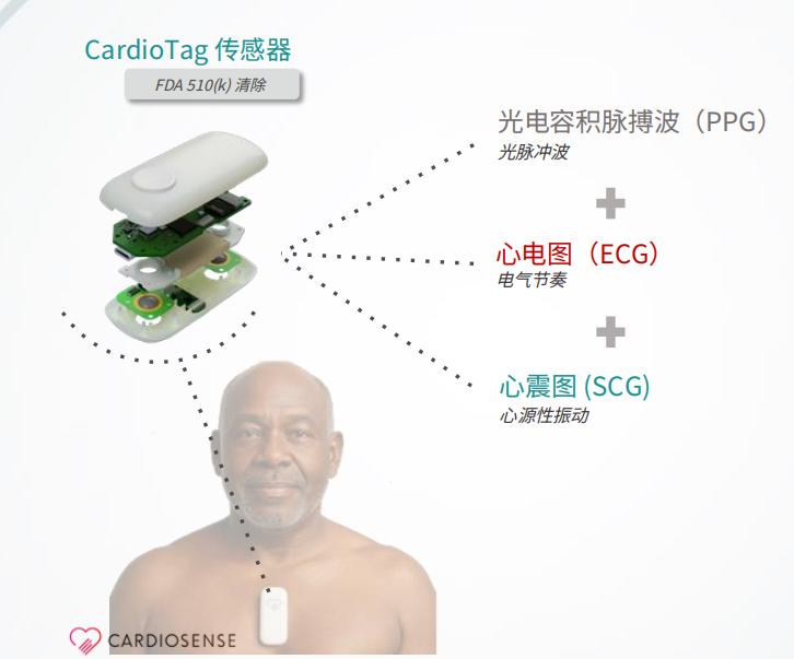 CardioTag：多模态心脏监测传感器设备 - GlobeHub